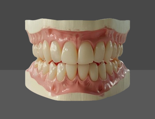 Acrylizing and polisihing full denture