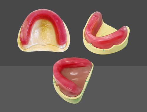 Occlusal rim per jaw