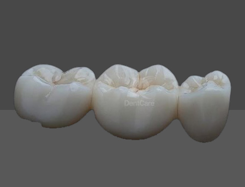 Classic Zirconia