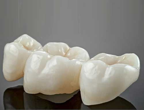 Premium Zirconia