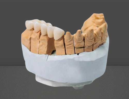 Regular Zirconia